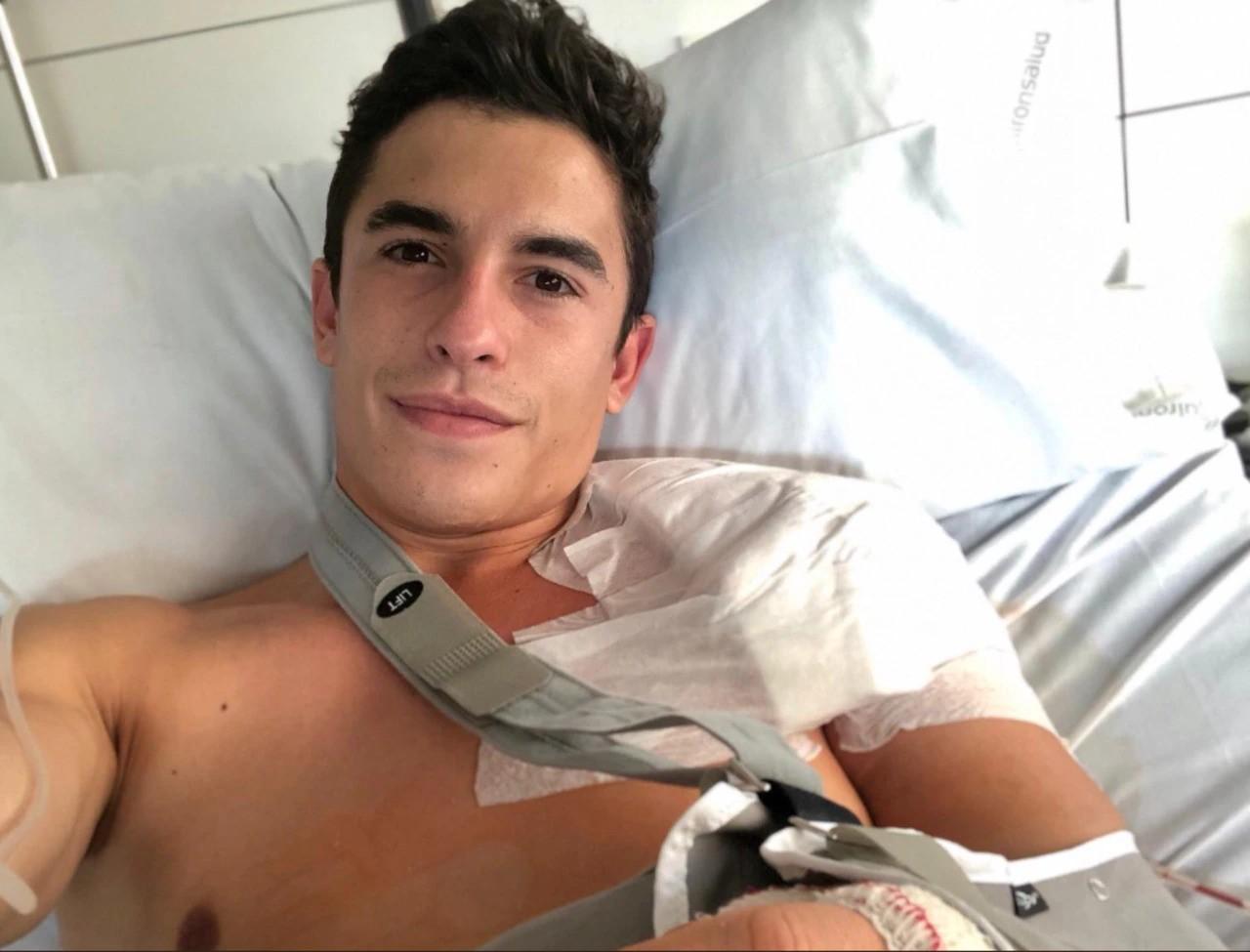 Marquez Jalani Operasi Bahu Usai Kecelakaan di Mandalika - JCCNetwork.id